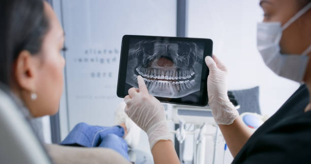 Licensed Tooth Extraction service in Burlington, NC - Smile Center Dentistry